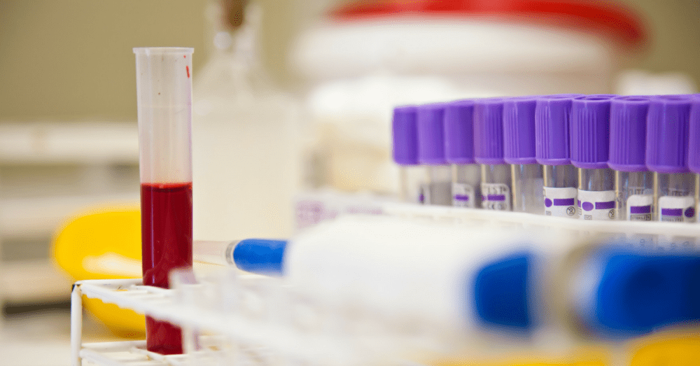 Labs mess Up 1 e1525874118192 | Varghese Summersett Crime labs make mistakes in DWI cases